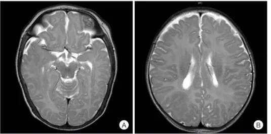 Fig. 1. Magnetic resonance imaging 