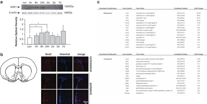 Figure 1 Upregulation of the levels of apoptosis signal-regulating kinase 1 (ASK1) and endogenous neural stem cells after cerebral ischemia