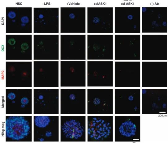 Figure 3 Photomicrographs of neural stem cells (NSCs) under apoptosis signal-regulating kinase 1 (ASK1) suppression conditions
