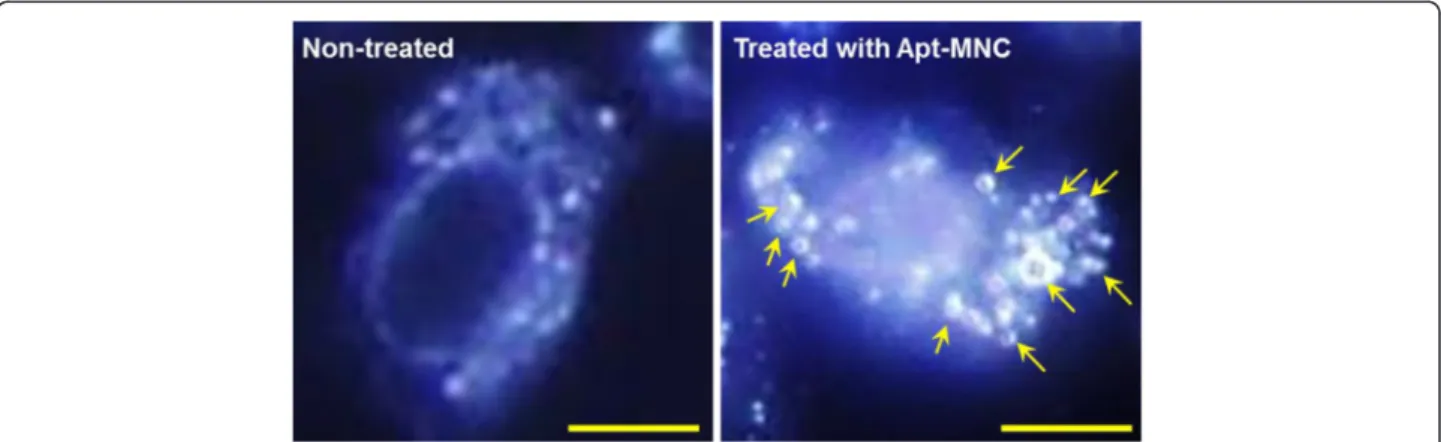 Figure 6 Dark-field microscopy images of PAE/KDR cells. (left panel) Non-treated and (right panel) treated with Apt-MNC; bars = 25 μm.