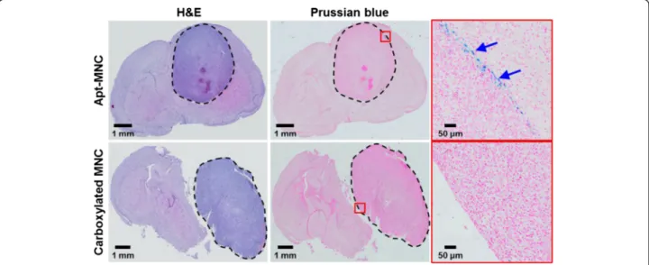 Figure 8 Representative photographs of the brain stained with H &amp; E and Prussian blue