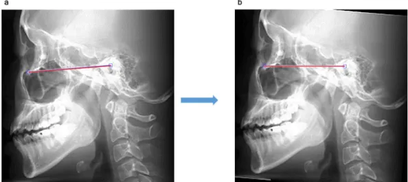 Figure 2.  Image reorientation (sagittal). (a) Using the average intensity projection image in the sagittal 