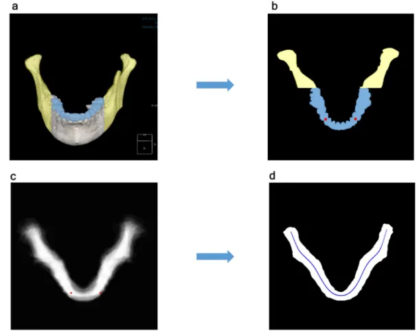 Figure 6.  The process of obtaining the average arch model using the segmented 3D image