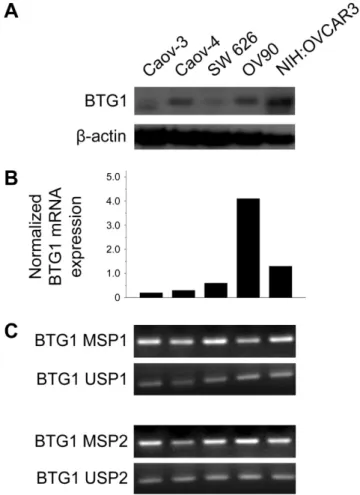 Figure 1.  BTG1 expression is downregulated by promoter methylation in 