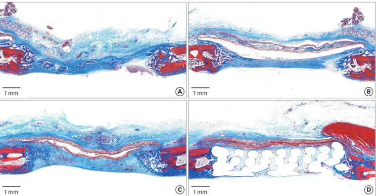 Figure 2.  Histologic observations at 2 weeks postoperatively. (A) Control group: the defect had collapsed, but woven bone structures were observed growing  from the peripheral area