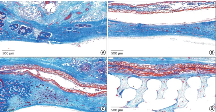 Figure 3.  Histologic observations at 2 weeks postoperatively. (A) Control group: a few bony islands were observed