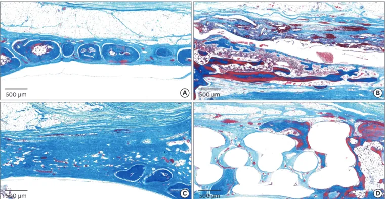 Figure 5.  Histologic observations at 8 weeks postoperatively. (A) Control group: formation of bony islands was observed in the central part of the defect