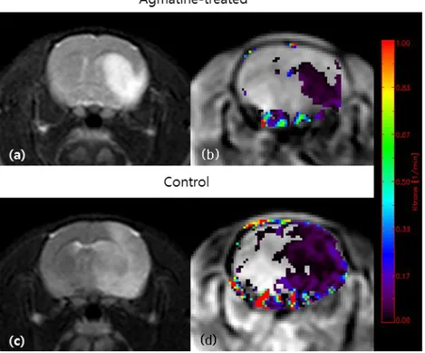 Figure  7.  Representative  images  of  MRI.  Infarcted  areas  can  be  seen  as  hyperintensity  on  T2-weighted  images  (a,  c)