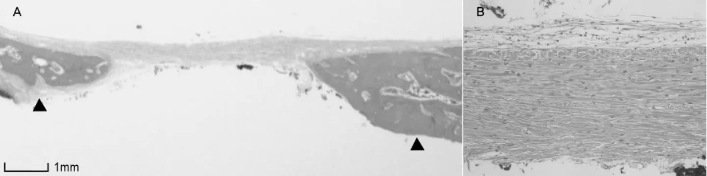 Figure 2. Light micrographs of control group at 4 weeks postoperatively. Thick fibrous tissue is covering the defect ×6 (A), ×200 (B).