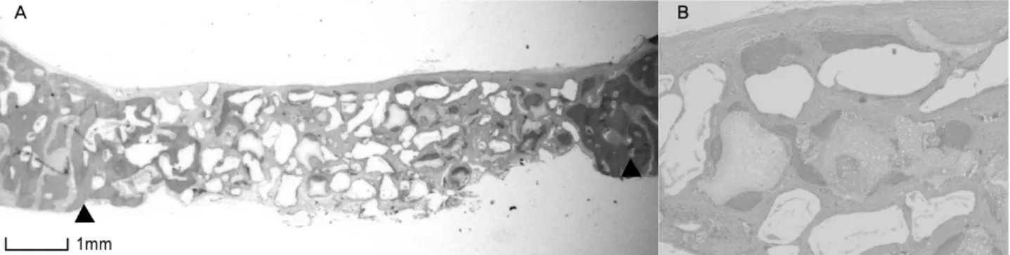Figure 6. Light micrographs of Bonemedik-DM at 4 weeks postoperatively. Active resorption process is observed ×16 (A), ×200 (B)
