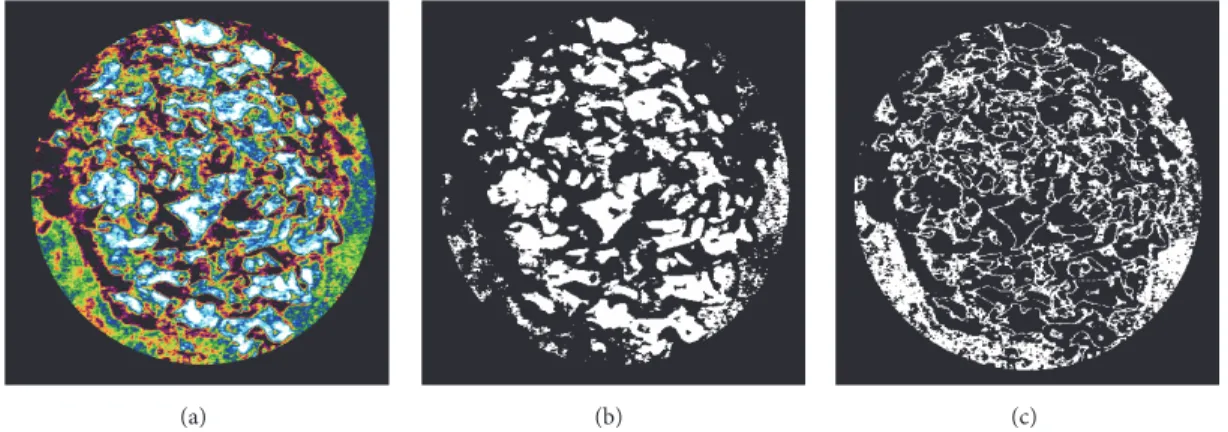 Figure 2: Gray scale of micro-CT analysis in surgical site. (a) Total bone (90-255); (b) residual material (135-255); (c) new bone (90-135).