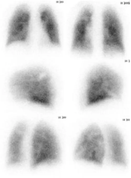 Fig. 3. This is the result image of the Posterior oblique method.