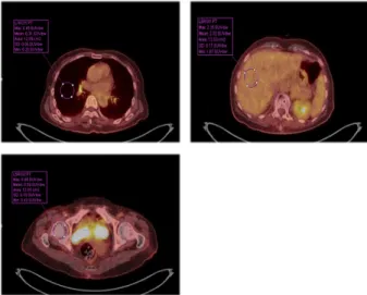 Fig. 6. Result image of CTAC of NEMA IEC Body Phantom.