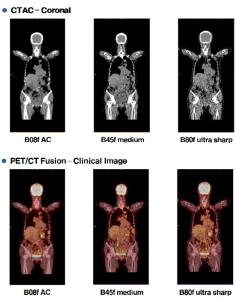 Fig. 9. The Coronal image of Clinical study.
