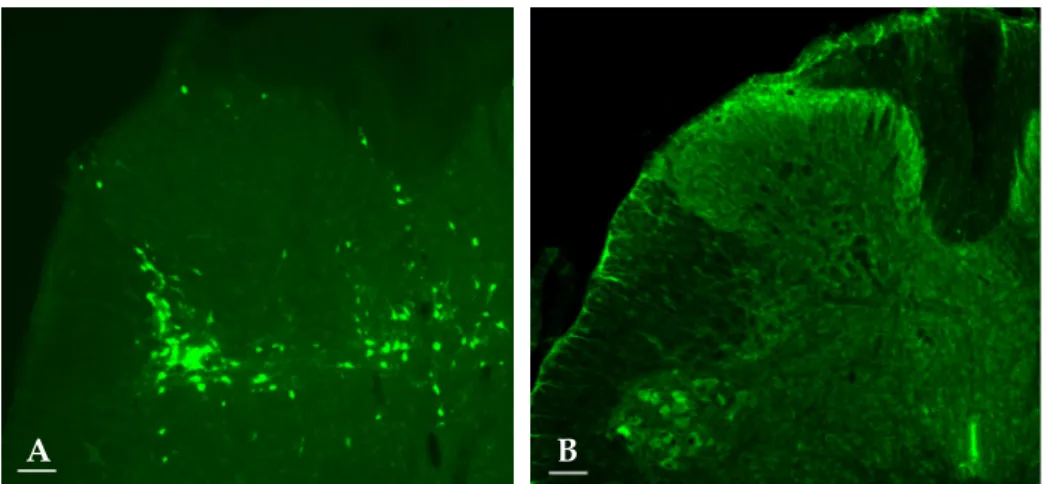 Fig. 1. Fluorescent photomicrographs of an L6 spinal cord section. Virus-labeled bladder neuron (green) at 3 days  postinfection (A)