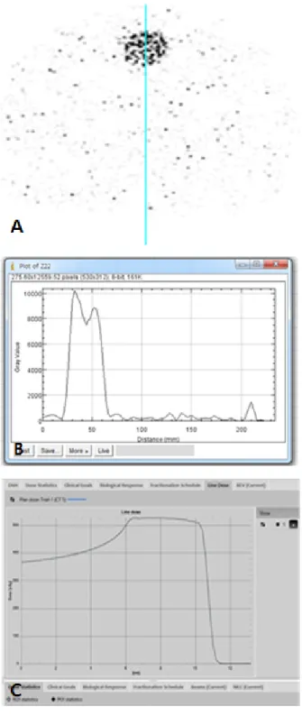 Fig. 6. (A) Obtained images is from PET