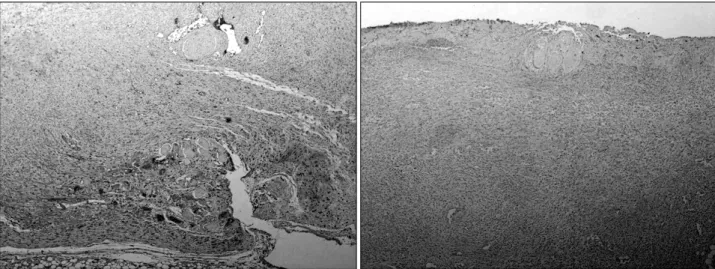 Fig. 4.  On  day  6,  the  specimen  of  wound  lesion  analysed  with  immunohistochemistry