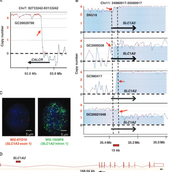 Fig. 1. Genomic breakpoint analysis of gastric cancer. (A) Representative example of a genomic breakpoint