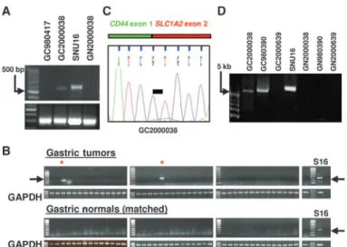 Fig. 3. CD44-SLC1A2 expression in primary GCs. (A) CD44-SLC1A2 RT-PCR on two index primary GCs (GC980417 and GC2000038) with SLC1A2  ge-nomic breakpoints (see Fig