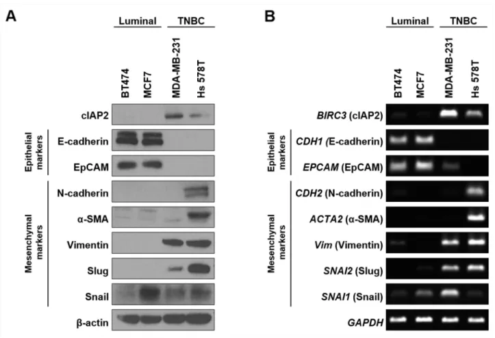 Figure 4: Comparison of cIAP2 expression and EMT-associated molecules in breast cancer cells