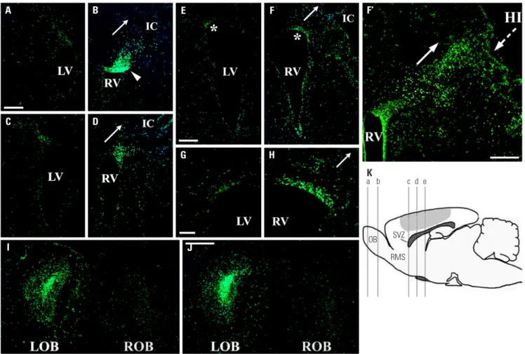 Fig. 1.  Proliferation and migration patterns of BrdU-labeled endogenous NSPCs in response to unilateral HI