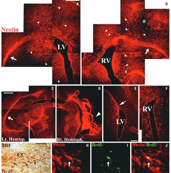 Fig. 3.  Unilateral HI promoted the maintenance of cerebral nestin expression. Compared with restricted nestin (red) expression bordering the lateral  ventricle in the intact brain of control mice on P8 (F), rapid and robust nestin expression was evident i