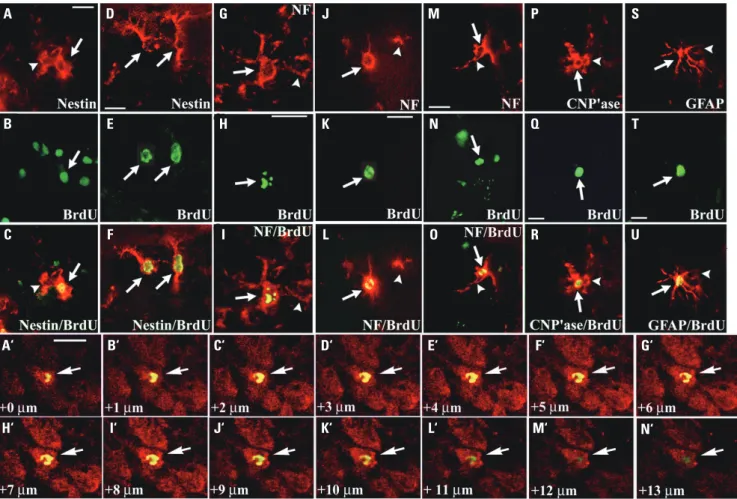 Fig. 4.  Differentiation pattern of BrdU-labeled NSPCs in response to HI. A day after unilateral HI and the final BrdU pulse, many cells around the V- V-SVZ (A-C) and in the cortex (D-F) of both hemispheres showed co-localization of both anti-nestin (A, D)