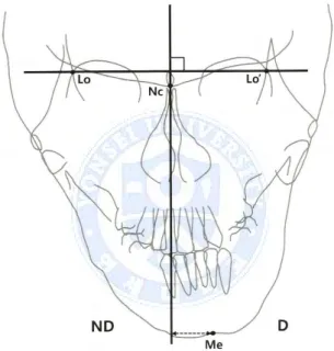 Figure  1.  Facial  midline  on  P-A  cephalograms.