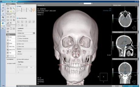 Figure  2.  Reconstruction  of  a  three-dimensional  image  using  OnDemand TM software 