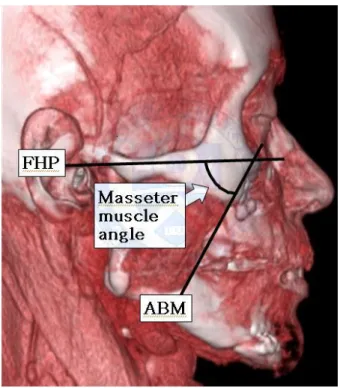 Figure  8.  Measurement  of  masseter  muscle  angle