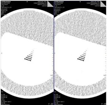 Fig. 9. Tube load changed according to shape of phantom when  applied AEC 