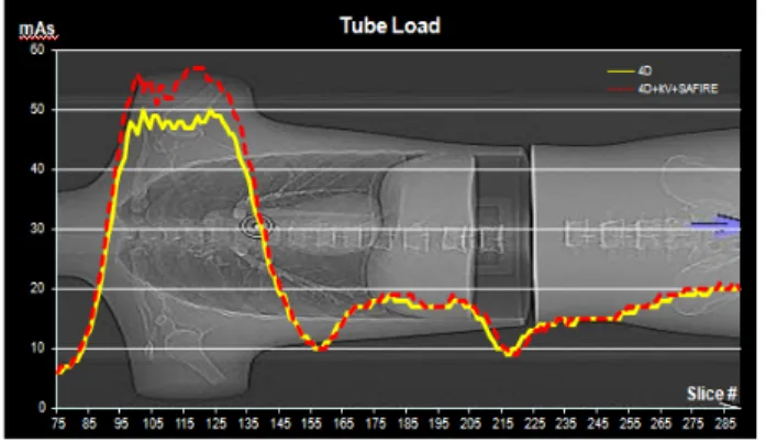 Fig. 15. Both of test(only AEC on and combination of 3 methods)  shows similar noise level and pattern