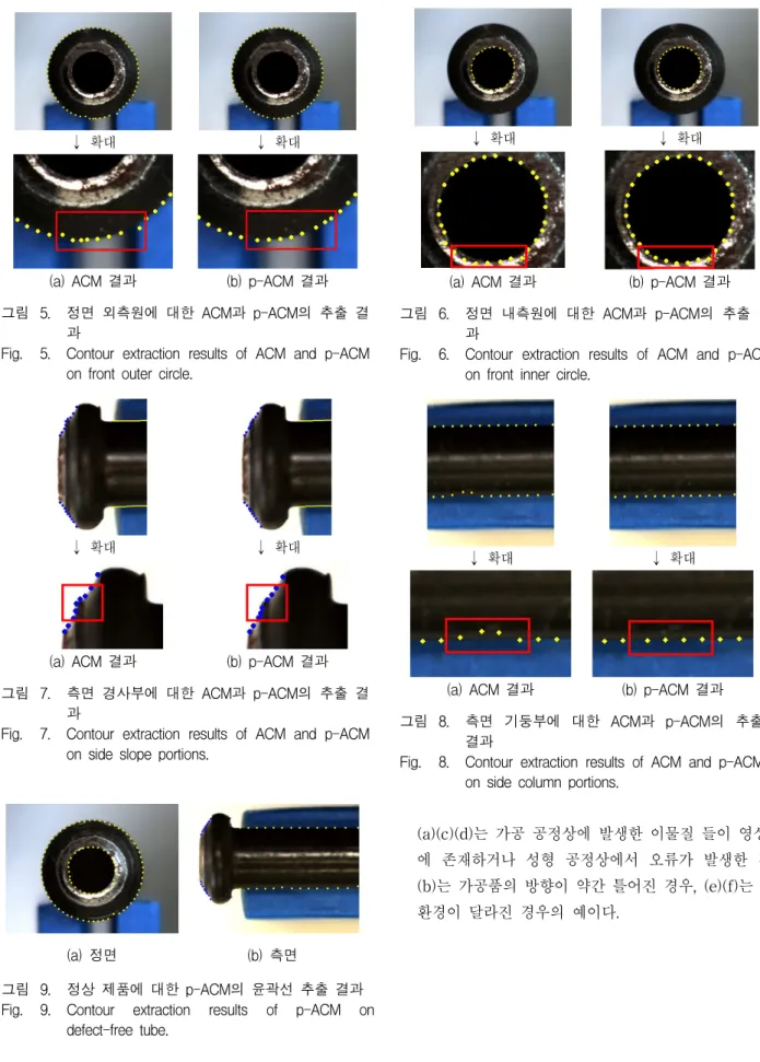 Fig. 5. Contour  extraction  results  of  ACM  and  p-ACM  on  front  outer  circle.