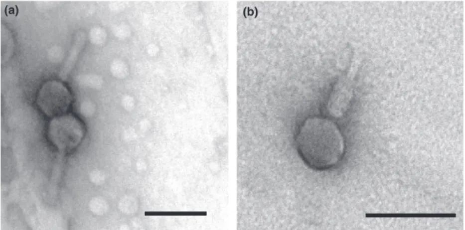 Figure 1 Images from transmission electron microscopy of Acinetobacter baumannii phages Β/-R1215 (a) and Β/-R2315 (b)