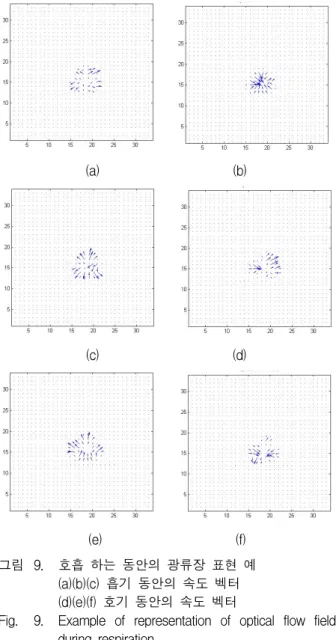 Fig. 9. Example  of  representation  of  optical  flow  field  during  respiration. 에서  3개의  값,  호기에서  3개의  값이  구해지게  된다