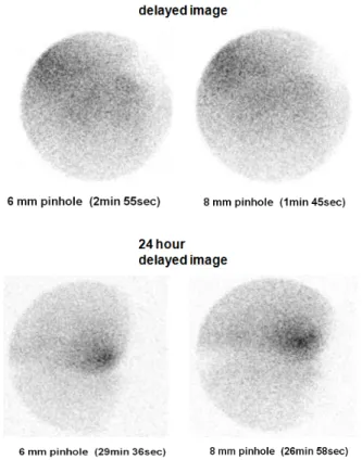 Fig. 10. 3 hour and 24 hour delayed image of T.M joint using 6 mm,  8 mm aperture.