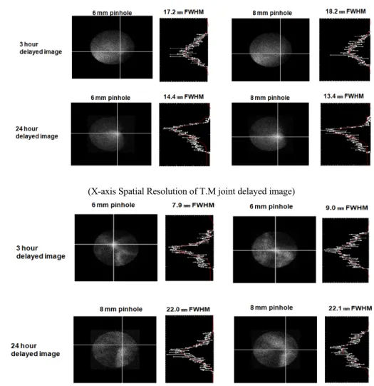 Fig. 13. Knee and T.M joint imaging perfomance using X-Profile a homemade analysis program