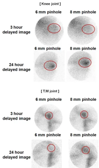 Fig. 14. Region of interest of knee and T.M joint delayed image  using 6 mm, 8 mm aperture