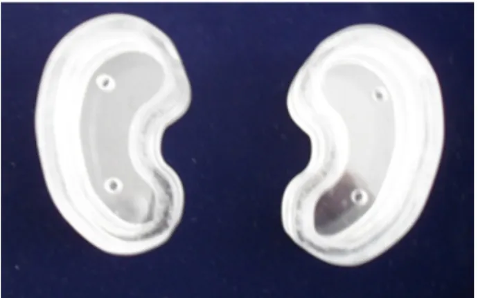 Fig. 1. Left and right two kidney phantoms of the form of a plane  were made based on a normal adult kidney.