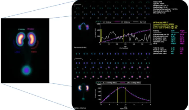 Fig.  5.  Acquired  images  were  analyzed  in  Xeleris  Functional  Imaging Workstation.