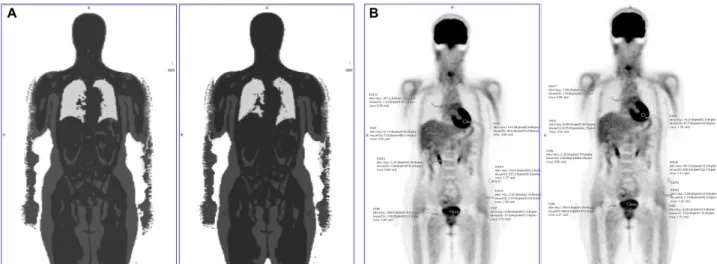 Fig. 9. Left image is coronal μ-map for applying attenuation correction of PET signal (A)