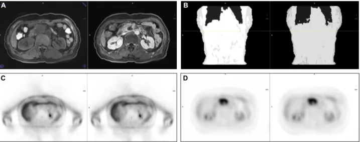 Fig. 11. Some distortion of bottle shape appeared. At high den- den-sity contrast media MRI μ-map.