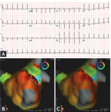 Figure 2. A case of a 62-year-old man who was treated for 