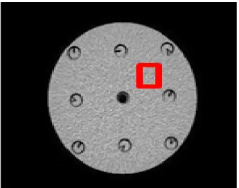 Fig. 7. This is linepair of QA CT phantom.