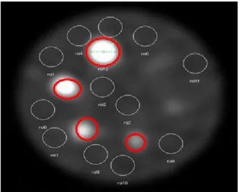 Fig. 8. 4 This is sphere ROI for SPECT image CNR estimation.  Fig. 9. This is radiation dose for CT conditions.