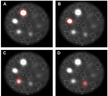 Fig. 13. This is drawing ROI of CNR estimation. 