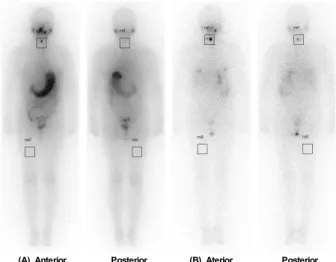 Fig. 3. An example of drawn square-shaped region-of-interest  (ROIs) to measure the I-131 uatake of the whole body in I-131  scintigraphy