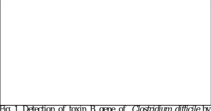 Fig. 1. Detection of toxin B gene of  Clostridium difficile by  PCR. Lane 1, negative control (D.W.); lanes 2 and 9, size  marker (123 bp); lane 3, positive control strain; lanes 4 to 8,  toxin B-positive strains; lane 10, toxin B-negative strain; lanes  1