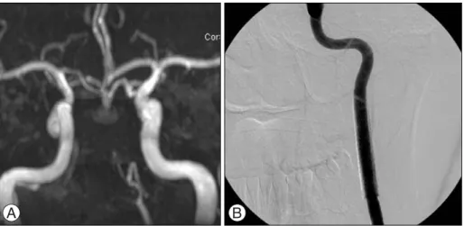 Fig. 3. (A) Follow-up MR angiography