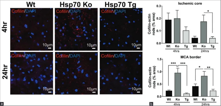 Figure 4: Hsp70 overexpression improves outcome from experimental stroke, whereas Hsp70 deficiency worsens it